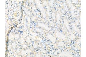 ABIN7094479 and ABIN7098528 at 1/100 staining Rat kidney tissue by IHC-P.