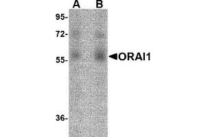 Western Blotting (WB) image for anti-ORAI Calcium Release-Activated Calcium Modulator 1 (ORAI1) (C-Term) antibody (ABIN492545) (ORAI1 antibody  (C-Term))