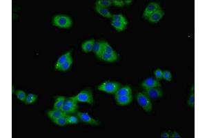 Immunofluorescent analysis of HepG2 cells using ABIN7172795 at dilution of 1:100 and Alexa Fluor 488-congugated AffiniPure Goat Anti-Rabbit IgG(H+L) (Transferrin Receptor antibody  (AA 94-754))