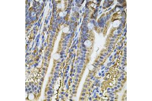 Immunohistochemistry of paraffin-embedded mouse intestine using NFU1 Antibody (ABIN2564134) at dilution of 1:100 (40x lens). (NFU1 antibody)