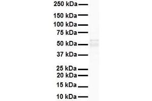 WB Suggested Anti-PPARA antibody Titration: 1 ug/mL Sample Type: Human heart (PPARA antibody  (N-Term))