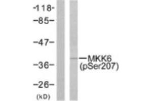 Image no. 1 for anti-Mitogen-Activated Protein Kinase Kinase 6 (MAP2K6) (pSer207) antibody (ABIN318071) (MAP2K6 antibody  (pSer207))
