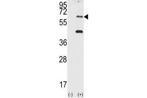 Western Blotting (WB) image for anti-Eukaryotic Translation Initiation Factor 2-alpha Kinase 2 (EIF2AK2) (AA 11-42) antibody (ABIN3030884)