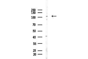 Western blot analysis of lysates from HepG2 cells(LPS, 4h treatment), using OSMR Antibody at 1/1000 dilution.