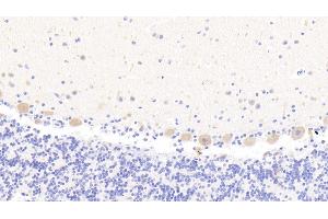 Detection of MAN1A1 in Human Cerebellum Tissue using Polyclonal Antibody to Mannosidase Alpha Class 1A Member 1 (MAN1A1) (MAN1A1 antibody  (AA 322-653))