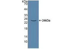 Detection of Recombinant PANX1, Human using Polyclonal Antibody to Pannexin 1 (PANX1) (PANX1 antibody  (AA 228-411))