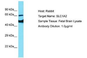 Host:  Rabbit  Target Name:  SLC1A2  Sample Type:  Fetal Brain lysates  Antibody Dilution:  1. (SLC1A2 antibody  (N-Term))