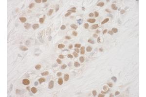 Immunohistochemistry (IHC) image for anti-Ribosomal Protein S6 Kinase, 90kDa, Polypeptide 5 (RPS6KA5) (AA 752-802) antibody (ABIN7453733)