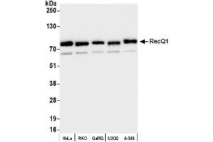 Western Blotting (WB) image for anti-RecQ Protein-Like (DNA Helicase Q1-Like) (RECQL) (AA 1-50) antibody (ABIN7453821) (RecQ Protein-Like (DNA Helicase Q1-Like) (RECQL) (AA 1-50) antibody)