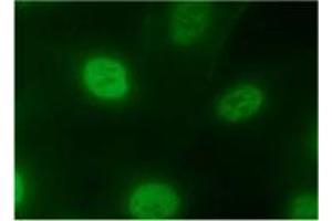 Immunofluorescence (IF) image for anti-Heterogeneous Nuclear Ribonucleoprotein A2/B1 (HNRNPA2B1) antibody (ABIN1449240)