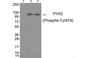 Western blot analysis of extracts from 3T3 cells (Lane 2) and HepG2 cells (Lane 3), using PYK2 (Phospho-Tyr579) Antibody. (PTK2B antibody  (pTyr579))