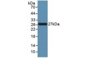 Detection of Recombinant FASL, Human using Polyclonal Antibody to Factor Related Apoptosis Ligand (FASL) (FASL antibody)
