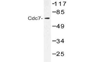 Western blot (WB) analysis of Cdc7 antibody in extracts from Jurkat cells.