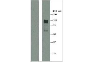 Western Blotting (WB) image for anti-Fibrinogen (citrullinated) antibody (ABIN1107223) (Fibrinogen antibody  (citrullinated))