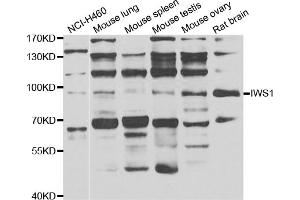 Western blot analysis of extracts of various cell lines, using IWS1 antibody (ABIN4904098) at 1:1000 dilution. (IWS1 antibody)
