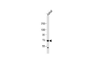 Anti-HAUS5 Antibody (N-term) at 1:1000 dilution + Jurkat whole cell lysate Lysates/proteins at 20 μg per lane.