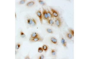 Anti-Hsp70 antibody, ICC ICC: A549 Cell