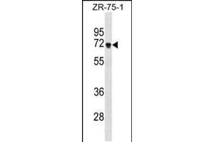 Western blot analysis in ZR-75-1 cell line lysates (35ug/lane). (ZNF654 antibody  (C-Term))