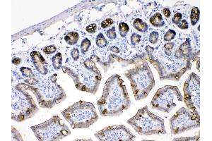 Immunohistochemistry (IHC) image for anti-Keratin 18 (KRT18) (AA 204-430) antibody (ABIN5518769)