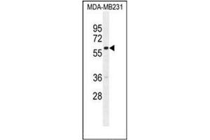 Western blot analysis of GNL3L Antibody (N-term) in MDA-MB231 cell line lysates (35ug/lane).
