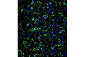 Confocal immunofluorescent analysis of P2 Antibody ABIN659033 with brain tissue followed by Alexa Fluor® 488-conjugated goat anti-mouse lgG (green). (MAP2 antibody)