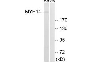 Western blot analysis of extracts from 293 cells, using MYH14 antibody. (Myosin antibody  (Internal Region))