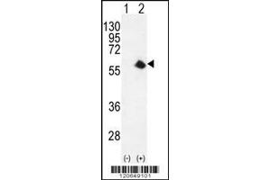 Western blot analysis of CDK8 using rabbit polyclonal CDK8 Antibody using 293 cell lysates (2 ug/lane) either nontransfected (Lane 1) or transiently transfected (Lane 2) with the CDK8 gene. (CDK8 antibody  (AA 249-277))