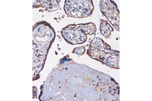 Immunohistochemistry of paraffin-embedded Human placenta using WDR61 Rabbit pAb (ABIN7271361) at dilution of 1:100 (40x lens). (WDR61 antibody  (AA 1-305))