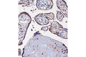 Immunohistochemistry of paraffin-embedded Human placenta using WDR61 Rabbit pAb (ABIN7271361) at dilution of 1:100 (40x lens).