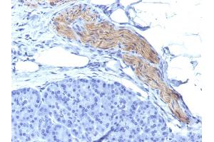 Formalin-fixed, paraffin-embedded human Pancreas stained with CD56 Mouse Monoclonal Antibody (NCAM1/795).