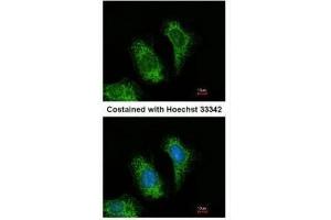ICC/IF Image Immunofluorescence analysis of methanol-fixed HeLa, using TRAF5, antibody at 1:200 dilution. (TRAF5 antibody  (N-Term))