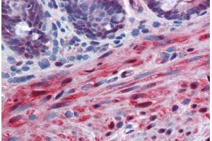 Human Colon, muscularis mucosa: Formalin-Fixed, Paraffin-Embedded (FFPE) (YAP1 antibody  (AA 53-162))