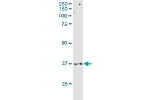CD200R1 MaxPab rabbit polyclonal antibody. (CD200R1 antibody  (AA 1-348))