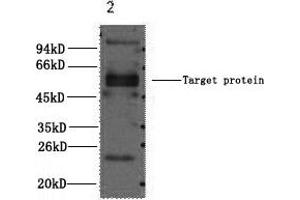 Western Blotting (WB) image for anti-Fc Fragment of IgE, Low Affinity II, Receptor For (CD23) (FCER2) antibody (ABIN5960827) (FCER2 antibody)