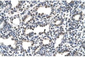 Immunohistochemical staining (Formalin-fixed paraffin-embedded sections) of human lung with KCTD6 polyclonal antibody . (KCTD6 antibody  (AA 32-70))