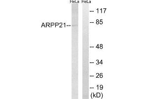 Western Blotting (WB) image for anti-cAMP-Regulated phosphoprotein, 21kDa (ARPP21) (Internal Region) antibody (ABIN1850974)