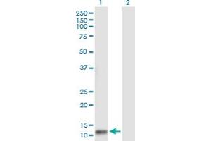 Western Blot analysis of FLJ37478 expression in transfected 293T cell line by FLJ37478 MaxPab polyclonal antibody.