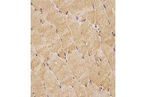 (ABIN6244021 and ABIN6578763) staining TK1 in human skeletal muscle tissue sections by Immunohistochemistry (IHC-P - paraformaldehyde-fixed, paraffin-embedded sections). (TK1 antibody  (AA 139-173))
