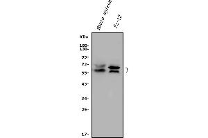 Western blot analysis of Rad9/Rad9a using anti-Rad9/Rad9a antibody (ABIN7599342).