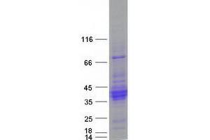 Validation with Western Blot (C21orf62 Protein (Transcript Variant 3) (Myc-DYKDDDDK Tag))