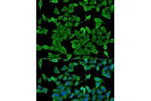 Immunofluorescence analysis of U2OS cells using ACTR2 Polyclonal Antibody (ACTR2 antibody)