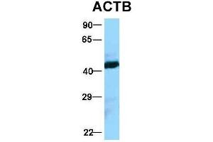 Host:  Rabbit  Target Name:  ACTB  Sample Type:  Jurkat  Antibody Dilution:  1.