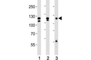 Western Blotting (WB) image for anti-Fibroblast Growth Factor Receptor 2 (FGFR2) (AA 7-37) antibody (ABIN3030951)