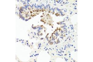 Immunohistochemistry of paraffin-embedded rat lung using AMBRA1 antibody.