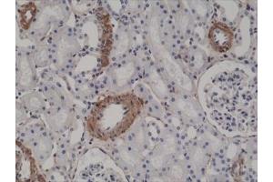 Immunohistochemistry (IHC) image for anti-Actin, alpha 2, Smooth Muscle, Aorta (ACTA2) (N-Term) antibody (ABIN4953290)