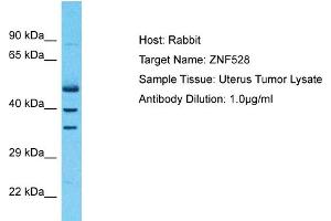 Host: Rabbit Target Name: ZNF528 Sample Type: Uterus Tumor lysates Antibody Dilution: 1. (ZNF528 antibody  (Middle Region))