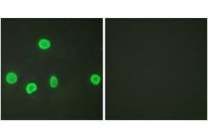 Immunofluorescence (IF) image for anti-Histone H3 (H3) (H3K18ac) antibody (ABIN2879163) (Histone 3 antibody  (H3K18ac))