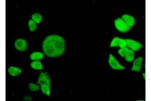 Detection of TNPO1 in Hela cells using Polyclonal Antibody to Transportin 1 (TNPO1) (Transportin 1 antibody  (AA 593-836))