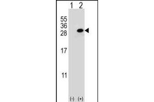 Western blot analysis of CLTA (arrow) using rabbit polyclonal CLTA Antibody (Center) (ABIN652956 and ABIN2842611). (CLTA antibody  (AA 99-127))