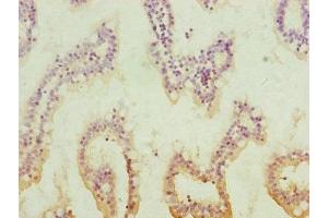 Immunohistochemistry of paraffin-embedded human small intestine tissue using ABIN7154039 at dilution of 1:100 (QRSL1 antibody  (AA 289-528))